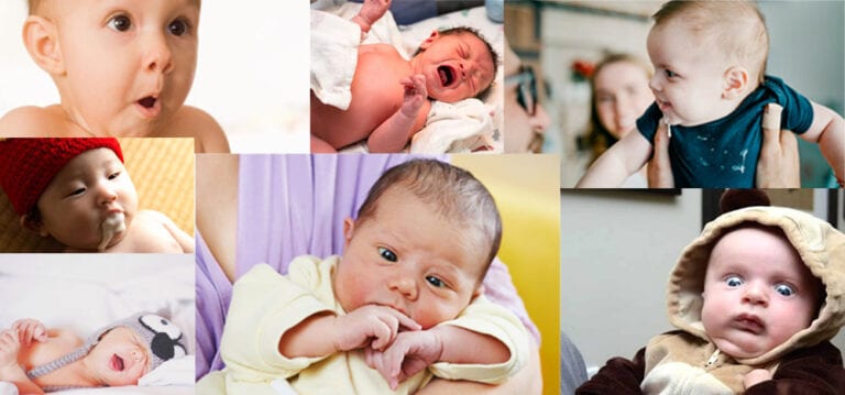 7 various abnormal symptoms In the body of a newborn baby